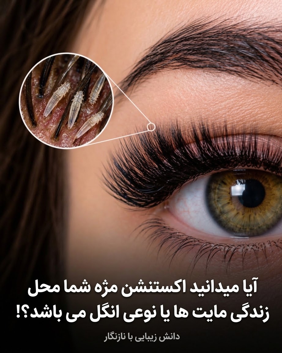 دمودکس و اکستنشن مژه | علت خارش و التهاب پلک + راه پیشگیری
